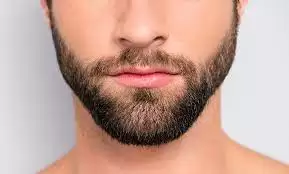 Essentials Things You Have to Know About Beard Transplant