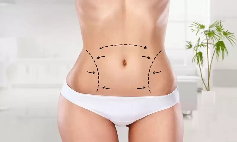 Uplifts Your Overall Personality With Stomach Fat Removal Liposuction Surgery!